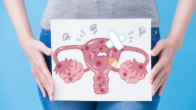 KankerServiks Penyebab Kematian Tertinggi Wanita di Indonesia